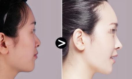 昆明專業(yè)整形治療醫(yī)院揭秘！口碑TOP10震撼推薦，守護(hù)您的隱私需求！