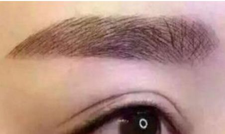 九院瞬間靚眼，告別上眼瞼下垂困擾，醫(yī)術(shù)專(zhuān)業(yè)獨(dú)具慧眼！