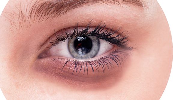 2023年北京最佳點痣醫(yī)院及祛斑費用查詢