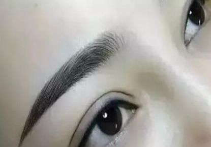 太原市最佳眉弓整形醫(yī)院排行榜2023年版附醫(yī)療收費(fèi)明細(xì)