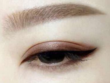 成都美萊雷狀醫(yī)生2023年隆鼻案例揭示：美貌與自然魅力統(tǒng)一修復(fù)