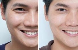 西安整容業(yè)近年來蓬勃發(fā)展，隆鼻手術(shù)備受矚目。在眾多醫(yī)生中脫穎而出的五位西安隆鼻名醫(yī)令人信服！他們來自