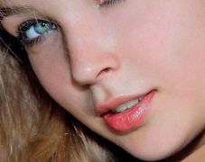 郭波雙眼皮手術(shù)效果如何？90天后恢復(fù)情況揭示