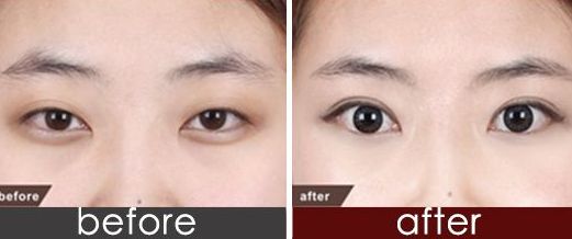 上海市九院品牌種植牙醫(yī)生推薦！頂尖口腔權(quán)威專家聯(lián)合推薦，價(jià)格一覽！