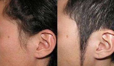 北京輕醫(yī)美整形醫(yī)院推薦，微整形首選！