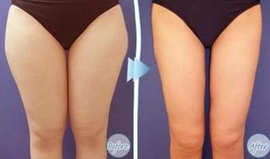 杭州痤瘡修復(fù)?？漆t(yī)院推薦