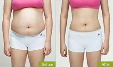 北京大學(xué)醫(yī)院割雙眼皮價(jià)格評(píng)估及專家團(tuán)隊(duì)介紹