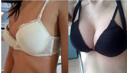 長沙雙眼皮手術(shù)：田芳斌與解燦哪位醫(yī)生更優(yōu)秀？前五專家詳細介紹！有必要留存~