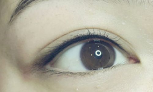 宋保強(qiáng)鼻部整形案例解析！西京整形醫(yī)生點(diǎn)評，知名醫(yī)院推薦