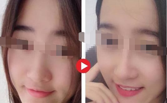 【2024年】蘇州哪家整形醫(yī)院口碑最好？評選出的前三強！