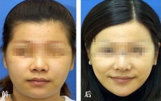 南京市靠譜的美容整形醫(yī)院哪家值得選擇？華美、美貝爾、華韓奇致等都是品質(zhì)過硬