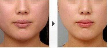 成都哪家醫(yī)院祛斑效果可靠？這兩家醫(yī)院躋身排行榜