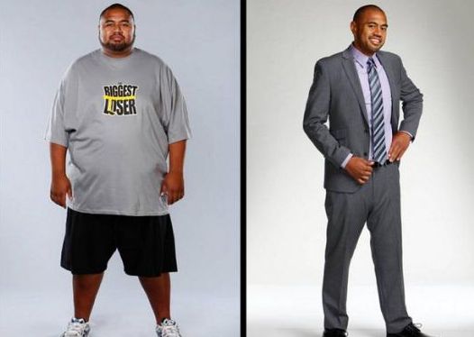 上海九院激光脫毛價格資訊，推薦專家選擇