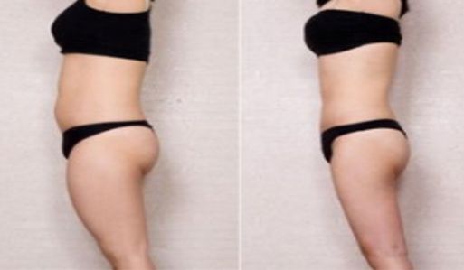 深圳最新刷新！這些除皺醫(yī)院排行榜上名列前茅！