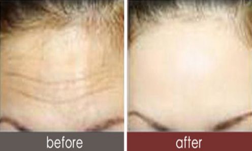 深圳整形科優(yōu)秀的頂級醫(yī)院有哪些？2023年醫(yī)院名單提前曝光！