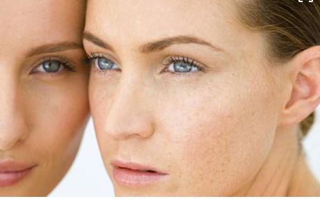 成都當(dāng)?shù)孛廊菡吾t(yī)院鼻部整形效果如何？真實(shí)案例發(fā)布！