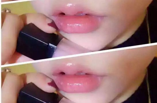 醫(yī)院明星醫(yī)生主刀隆胸真實(shí)感受揭秘