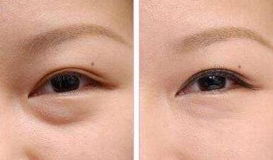 上海九院種植牙醫(yī)生推薦：這幾位牙醫(yī)技術獨特，深受患者好評！