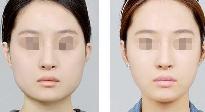 柳州嘴唇補水效果好的醫(yī)院推薦