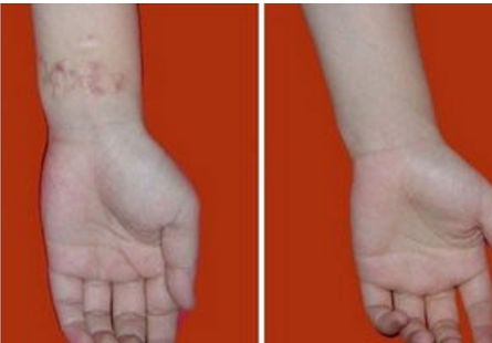 深圳龍華地區(qū)熱門整形醫(yī)院排名公開！