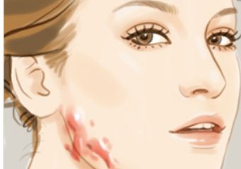 北京哪家醫(yī)院可以洗紋身呢？