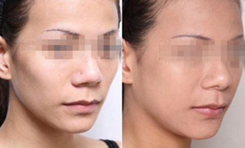 寧波權(quán)威眼科醫(yī)院匯總：地址、專家一覽表