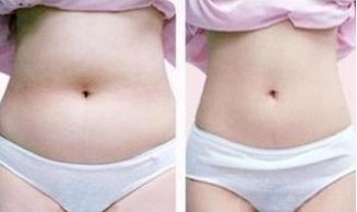 華西整形美容科報(bào)價(jià)目錄及專家優(yōu)勢(shì)評(píng)測(cè)