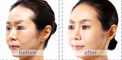 成都哪家醫(yī)院適合皮膚美容？