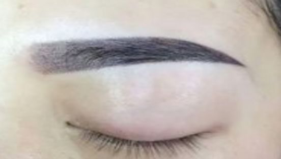 大連微整形醫(yī)院，注重玻尿酸填充技術(shù)優(yōu)勢(shì)