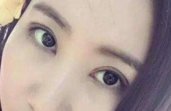 上海華東醫(yī)院整形外科主任醫(yī)師榜單揭曉！先進(jìn)隆鼻療法案例分享及費(fèi)用明細(xì)，急需閱讀！