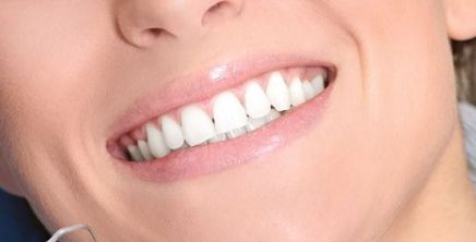 西京醫(yī)院鼻部整形丨馬顯杰教授，項(xiàng)目介紹與真人案例圖解析