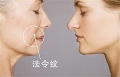 美麗改變，趙德星鼻子整形前后對比，驚艷有度！