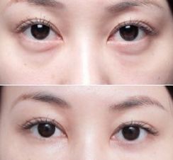 上海美萊醫(yī)院的療效一流，備受好評(píng)的醫(yī)生大揭秘！