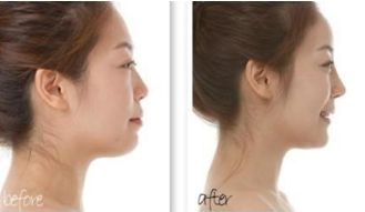 廣州植發(fā)全新醫(yī)院排行榜，權(quán)威榜單公布，趕緊收藏！