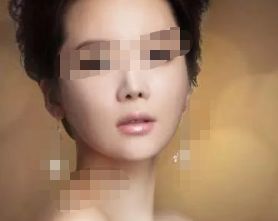 珠海有哪些專業(yè)整形醫(yī)院值得推薦？