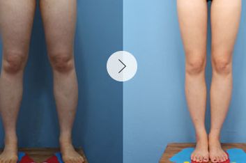 鄭州百家整形醫(yī)院2023最佳醫(yī)療中心大揭秘