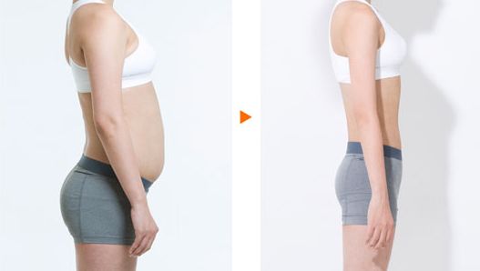 陳振宇的雙眼皮手術(shù)效果如何？在青醫(yī)附院的真實(shí)案例鑒賞提供參考