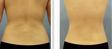 2023年溫州地區(qū)出現(xiàn)多位肋骨鼻醫(yī)生上榜！