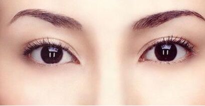 霍玉旺：中國鼻型塑造的頂尖大師！真實案例揭秘！