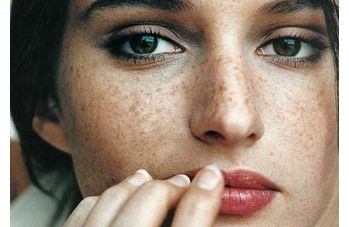 上海九院姜陶然醫(yī)生給您帶來玻尿酸面部煥新！2023案例公開揭秘