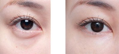 沈陽整形醫(yī)院精心挑選，排名領(lǐng)先醫(yī)院揭曉