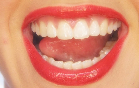 北京八大處有哪些專業(yè)的吸脂醫(yī)生？高端專家如何排隊？吸脂手術收費標準及參考價格都有哪些呢？