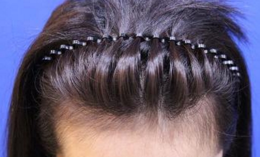 2023年無錫哪家醫(yī)院更適合做整形手術(shù)？公立還是私立更靠譜？能省錢還能變美嗎？