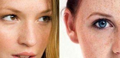 黃久佐醫(yī)生為你分享雙眼皮效果及技術(shù)測評！