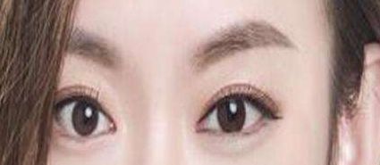 貴陽美貝爾徐威鼻子整形效果如何？90天親身經(jīng)歷曝光案例揭秘