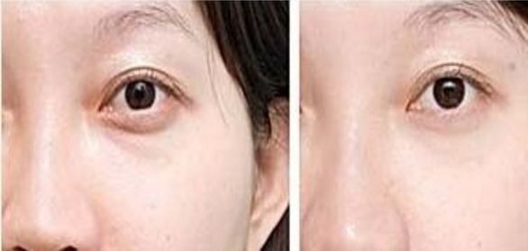 上海排名靠前的整形醫(yī)院推薦，想知道哪家好？最受歡迎的三甲醫(yī)療機(jī)構(gòu)名單已公布！