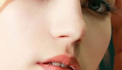 上海久雅醫(yī)療美容整形醫(yī)院隆鼻案例分享