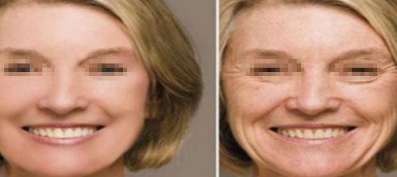 大連許英醫(yī)療美容如何？找到適合你的完美美容之處