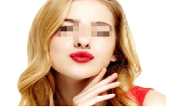 鄭州美萊枝蔓雙眼皮手術評價分享，價格公道有保障