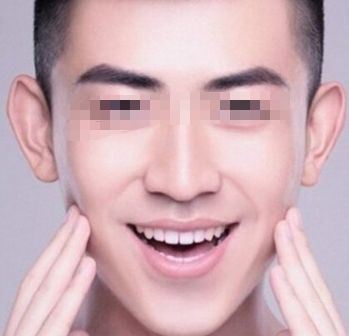 北京治疤痕手術哪家醫(yī)院好？